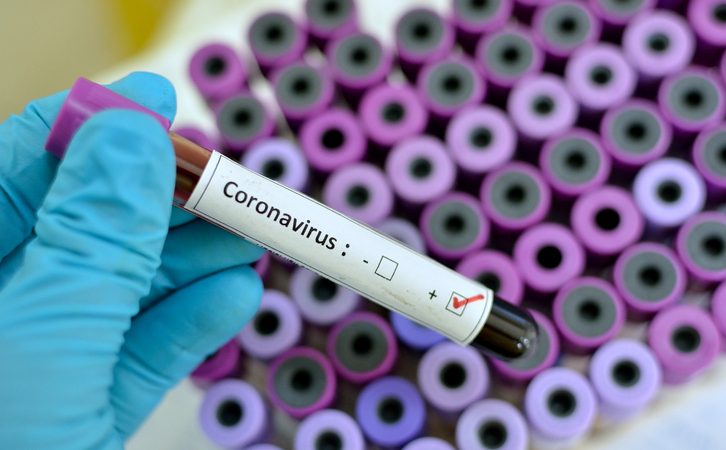 Medidas de Prevenção e Controle que devem ser adotadas durante a assitência aos casos suspeitos ou confirmação de infecção pelo novo Coronavirus (SARS-CoV-2)